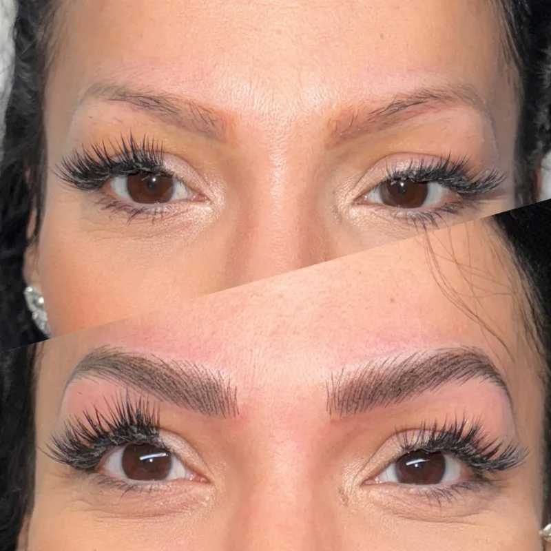 dermopigmentare-Visage-Clinique-001