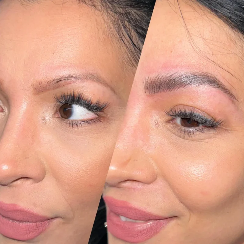 dermopigmentare-Visage-Clinique-003