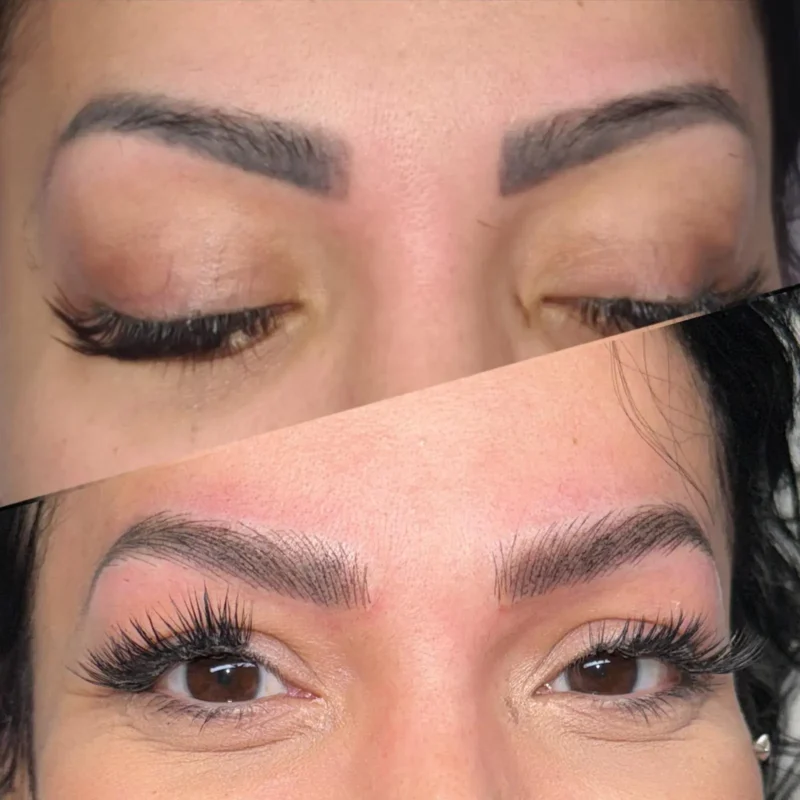 dermopigmentare-Visage-Clinique-004