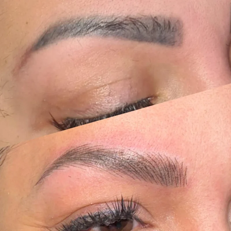 dermopigmentare-Visage-Clinique-005