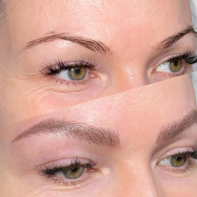 dermopigmentare-Visage-Clinique-019