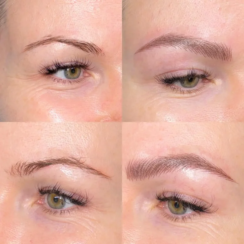 dermopigmentare-Visage-Clinique-020
